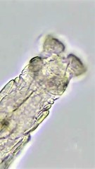 Macrotrachela ambigua