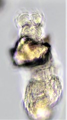 Macrotrachela ambigua