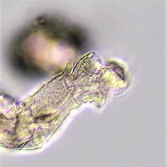 Macrotrachela ambigua