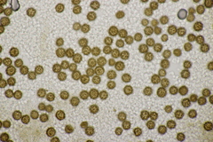 Scleroderma verrucosum