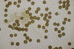 Scleroderma verrucosum