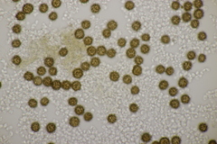 Scleroderma verrucosum