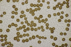 Scleroderma verrucosum