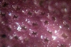 Stylantheca papillosa