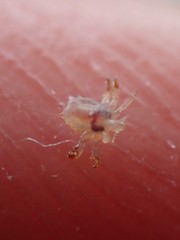 Pthirus pubis