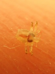 Pthirus pubis