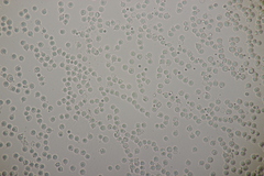 Limacella delicata glioderma