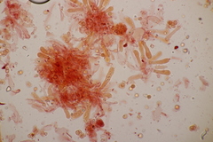 Limacella delicata glioderma