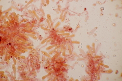 Limacella delicata glioderma