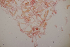 Limacella delicata glioderma