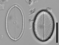 Cocconeis placentula