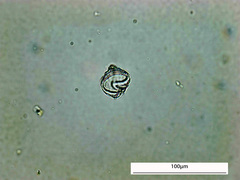 Protoperidinium