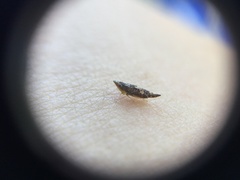 Cicadellidae