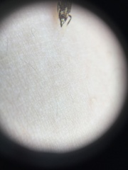 Cicadellidae
