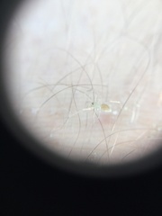 Araneae
