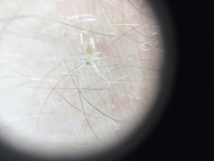 Araneae
