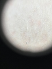Arthropoda
