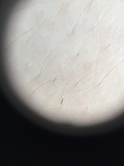 Arthropoda