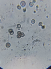 Rhizopus stolonifer