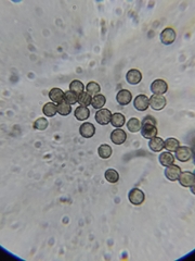 Rhizopus stolonifer