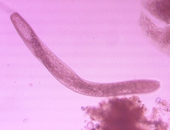 Spirostomum ambiguum