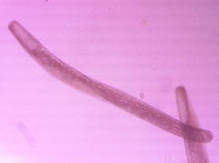 Spirostomum ambiguum