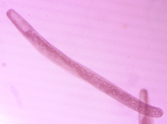 Spirostomum ambiguum