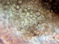 Pyrenopeziza benesuada