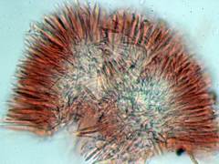 Pyrenopeziza benesuada