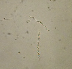 Spirochaetae