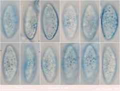 Trichophaea gregaria