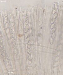 Trichophaea gregaria