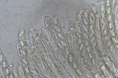 Peziza echinospora