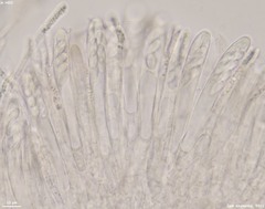 Hymenoscyphus imberbis