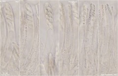 Hymenoscyphus imberbis