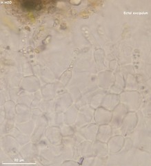 Hymenoscyphus imberbis