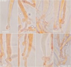 Hymenoscyphus imberbis