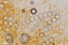 Ramsbottomia asperior