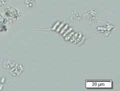 Desmodesmus bicaudatus