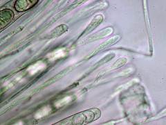 Scutellinia hirta