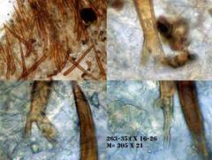 Scutellinia hirta