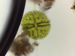 Micrasterias denticulata