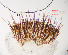 Trichophaeopsis paludosa