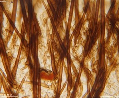 Trichophaeopsis paludosa
