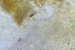 Ascobolus crenulatus