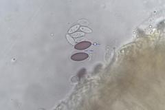 Ascobolus hawaiiensis