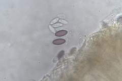 Ascobolus hawaiiensis