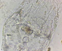 Collotheca