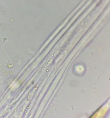 Collotheca