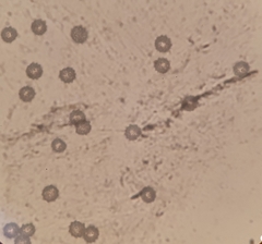 Laccaria violaceonigra